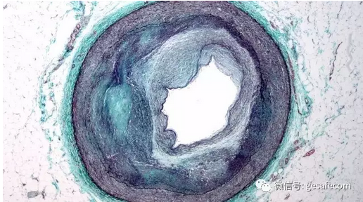 20161229180855035503.png